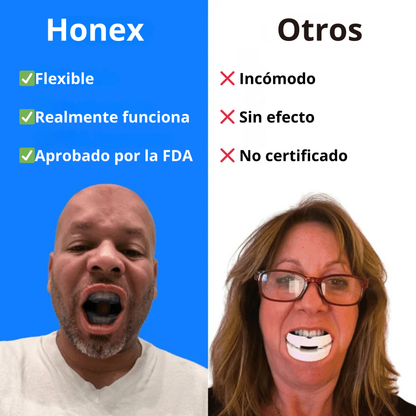 Honex - Boquilla Anti-Ronquidos